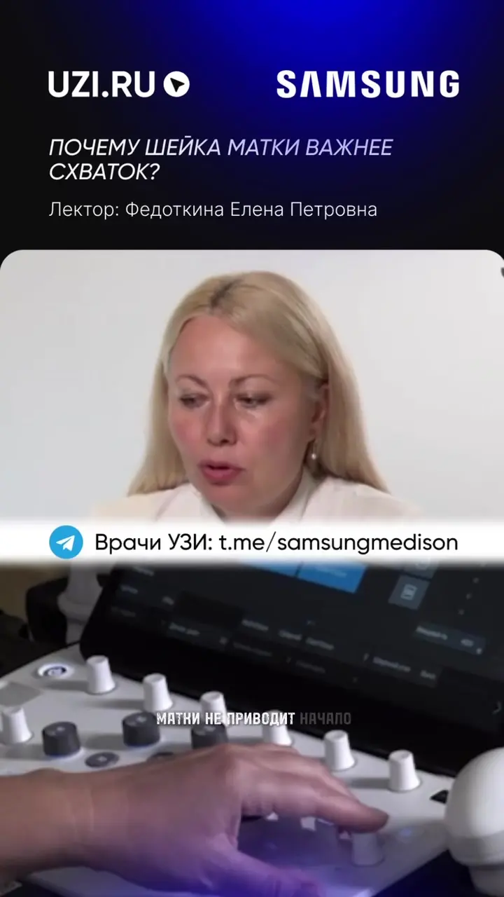 Акушерство: Почему шейка матки важнее схваток? — Федоткина Елена Петровна
