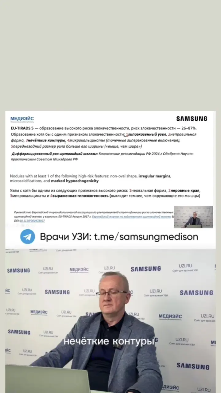 Щитовидная железа: Почему EU-TIRADS 5 сбивает врачей с толку? — Григорчук Святослав Евгеньевич