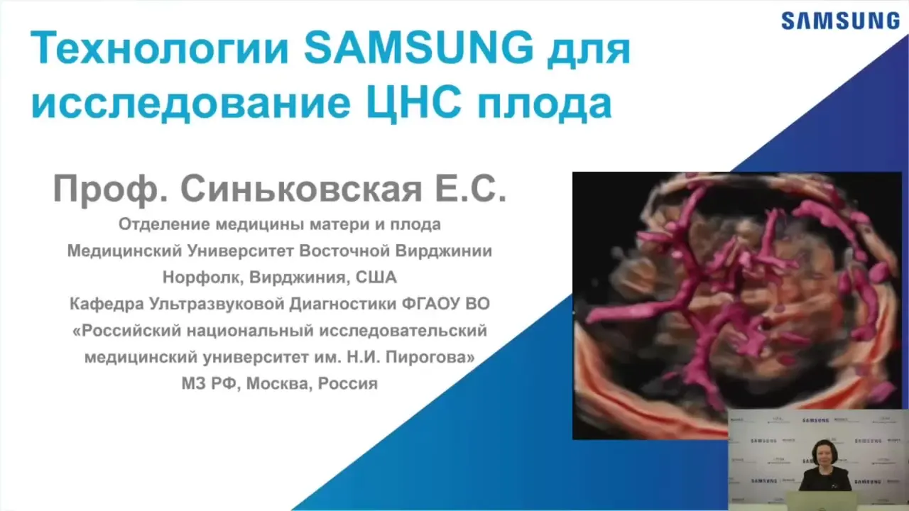 Превью: Технологии Samsung для исследования ЦНС плода