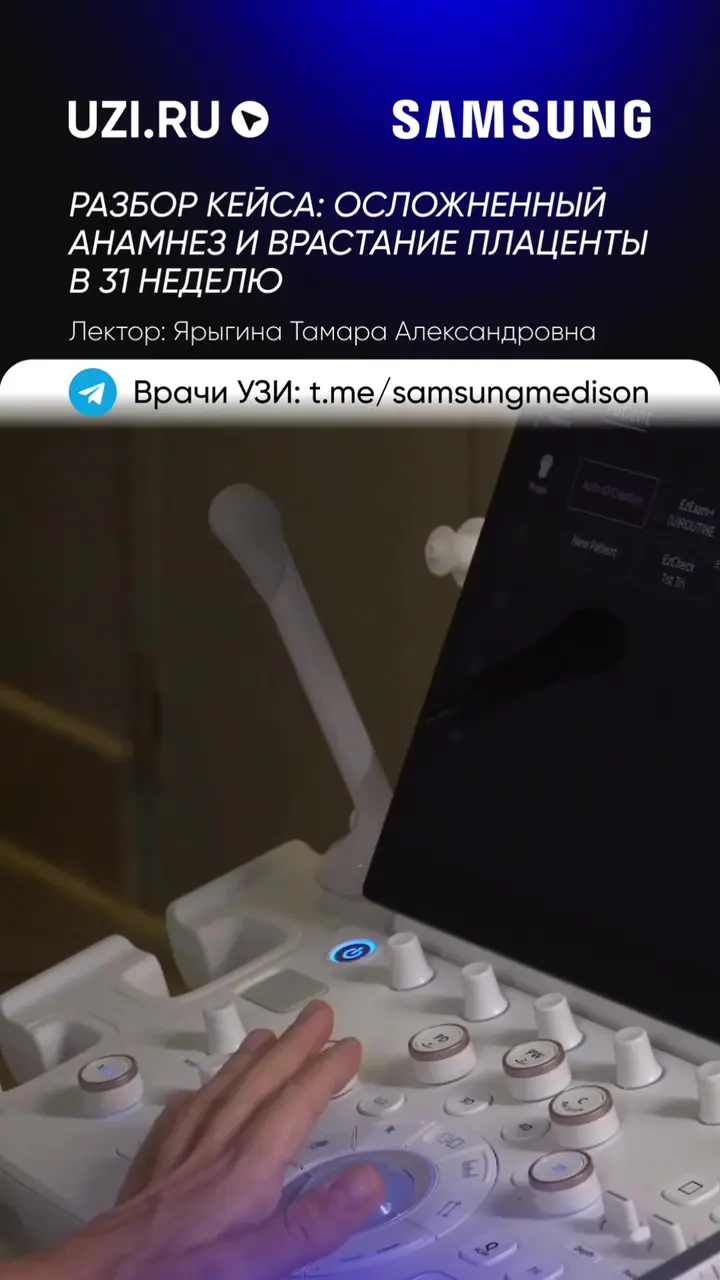 Акушерство: Разбор кейса: осложнённый анамнез и врастание плаценты в 31 неделю — Ярыгина Тамара Александровна