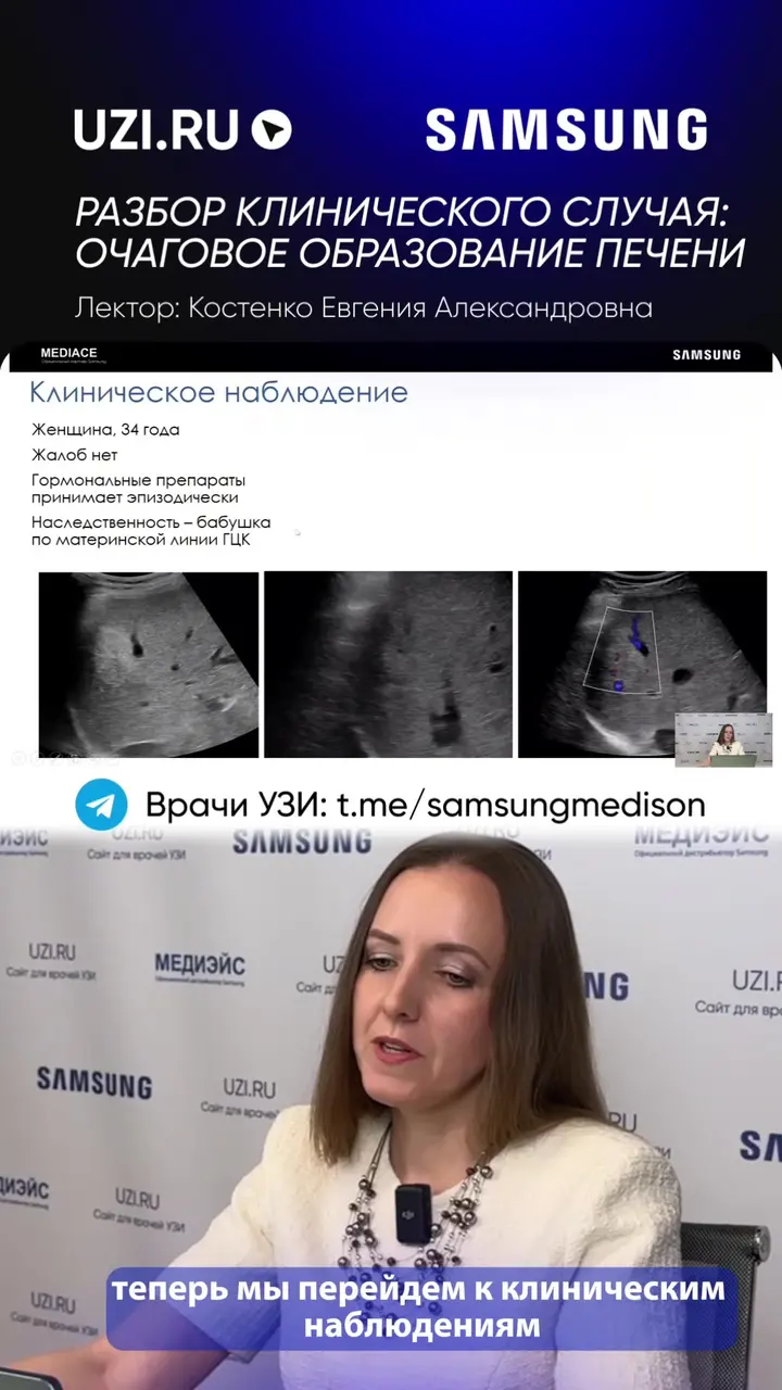 Печень: Разбор клинического случая: очаговое образование печени — Костенко Евгения Александровна