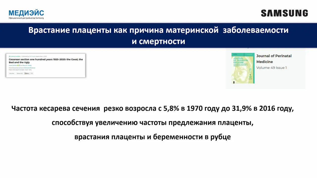 Превью: Современные технологии Samsung в скрининге врастания плаценты