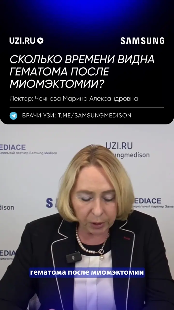 Гинекология: Сколько времени видна гематома после миомэктомии? — Чечнева Марина Александровна