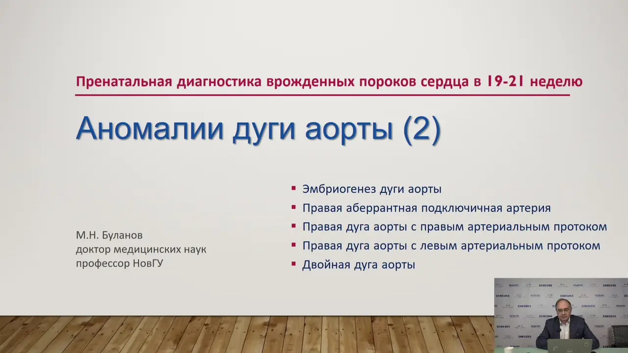 Превью: Аномалии дуги аорты у плода с клиническими примерами