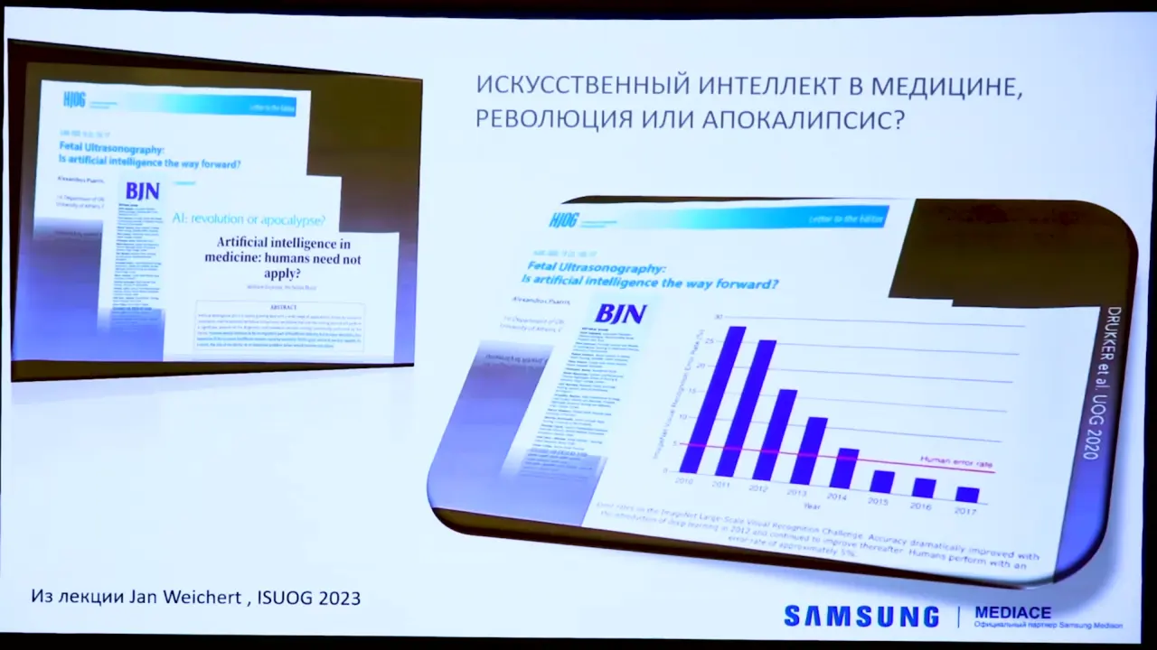 Превью: Роль современной ультразвуковой диагностики с программным искусственным интеллектом (BiometryAssist™, ViewAssist™, HeartAssist™) в наблюдении и ведении плода с задержкой роста. РАСУДМ 2023 г.