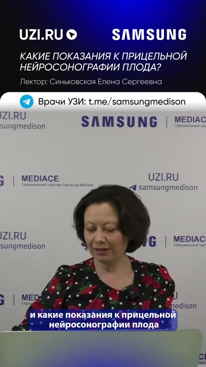 Акушерство: Какие показания к прицельной нейросонографии плода? — Синьковская Елена Сергеевна