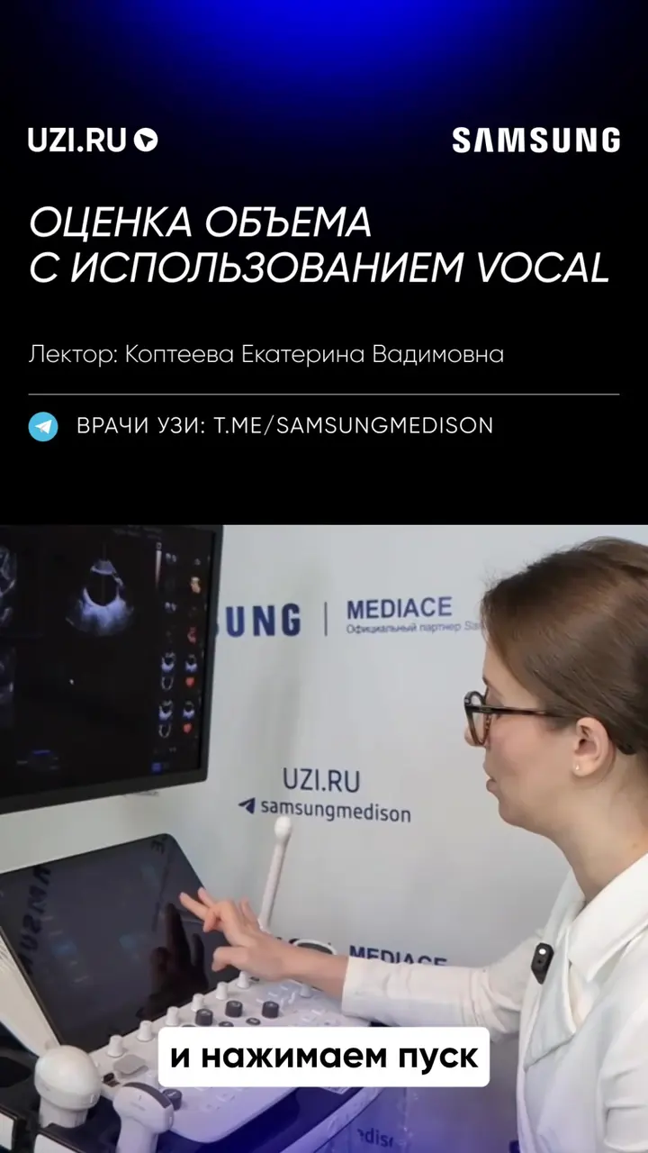 Гинекология: Оценка объёма с использованием VOCAL — Коптеева Екатерина Вадимовна
