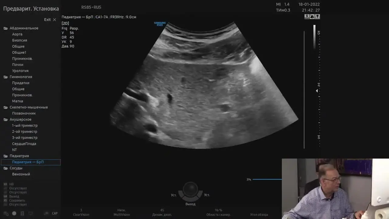 Превью: Рак поджелудочной железы: ультразвуковая диагностика