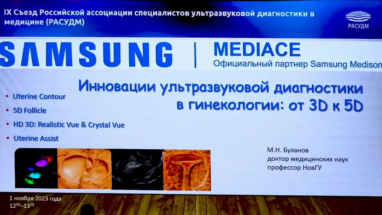 Превью: Инновации ультразвуковой диагностики в гинекологии: 3D, 4D, 5D. РАСУДМ 2023 г.