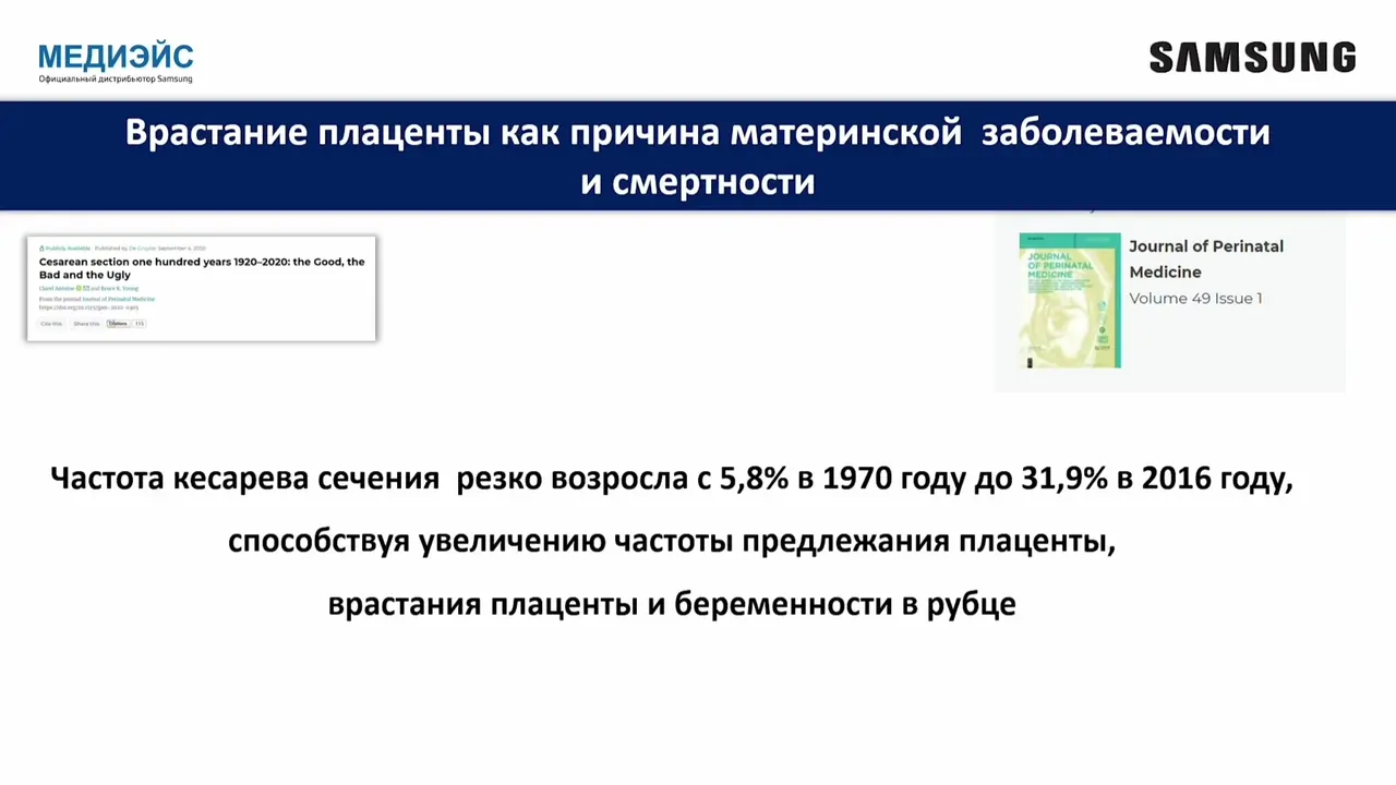 Превью: Современные технологии Samsung для скрининговых исследований у пациенток с врастанием плаценты