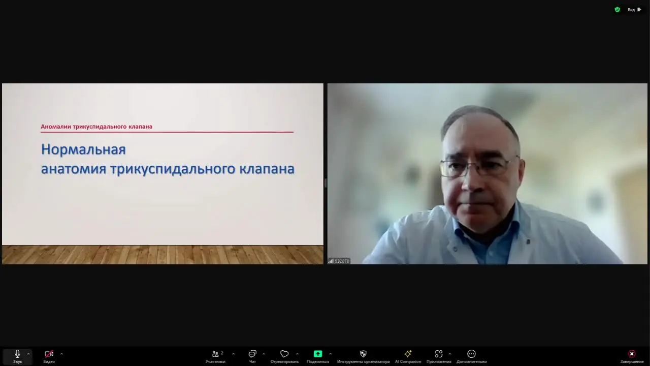 Превью: Трикуспидальная регургитация у плода — маленькая верхушка большого айсберга