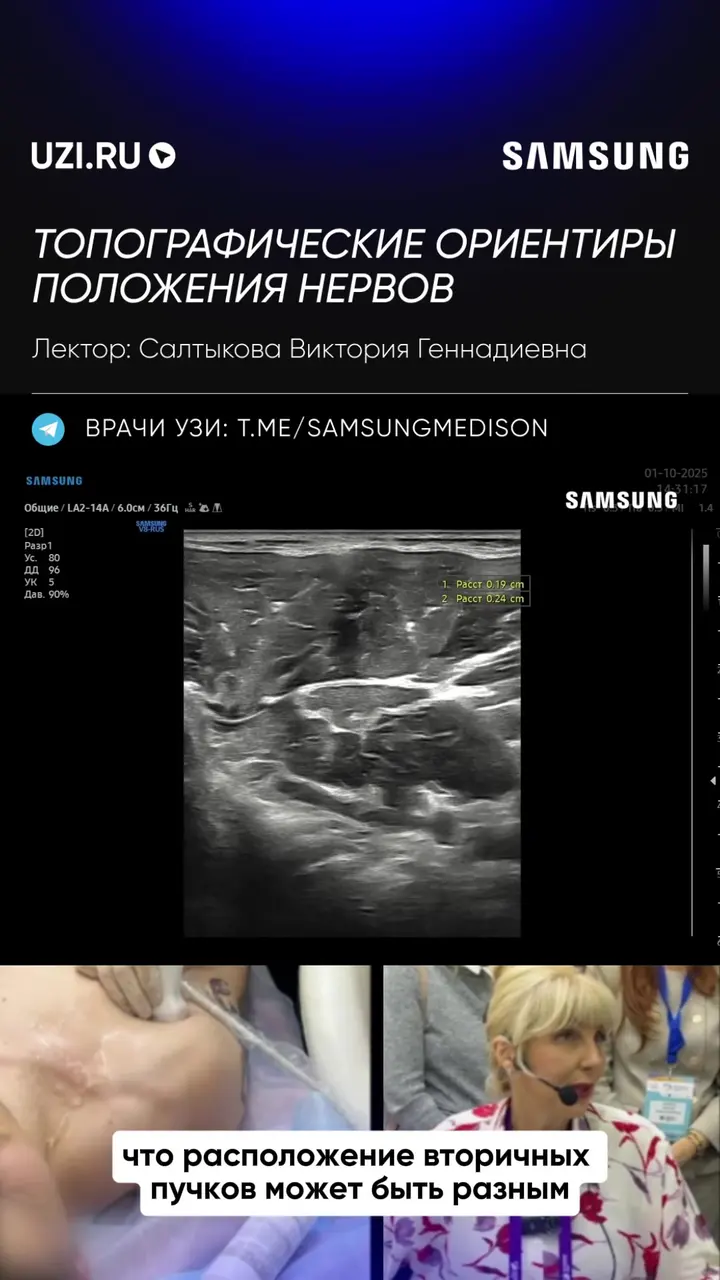 Опорно-двигательная система: Топографические ориентиры положения нервов — Салтыкова Виктория Геннадиевна