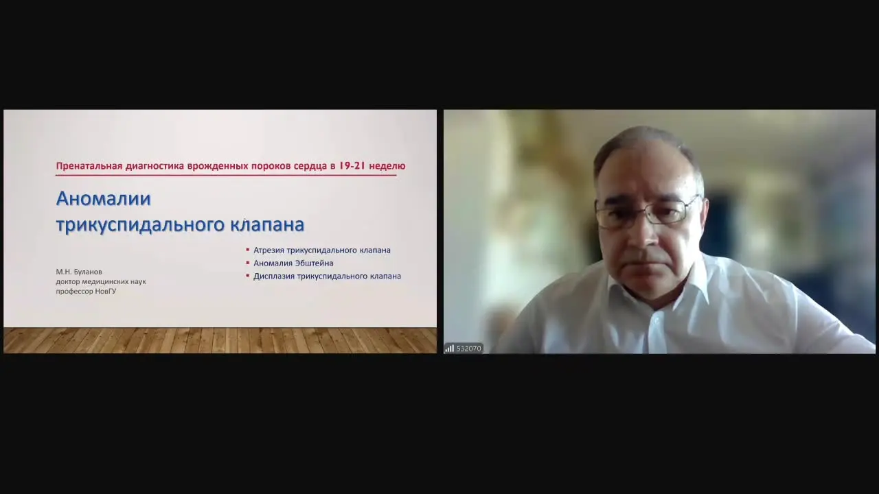 Превью: Аномалии трикуспидального клапана