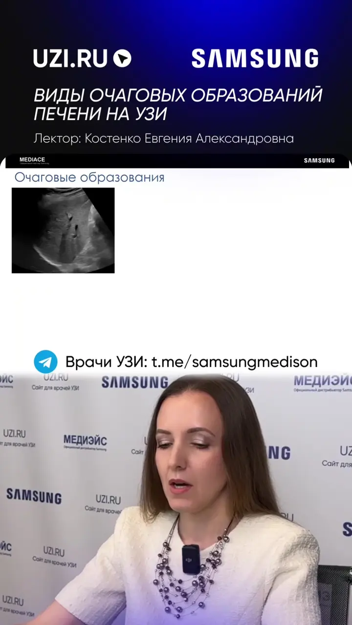 Печень: Виды очаговых образований печени на УЗИ — Костенко Евгения Александровна
