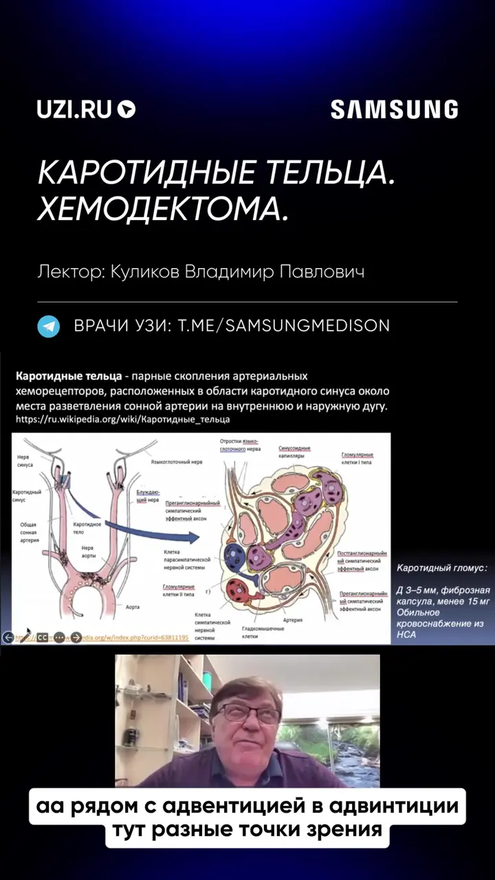 Сосуды: Каротидные тельца. Хемодектома — Куликов Владимир Павлович