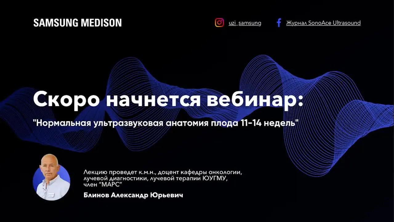 Превью: Нормальная ультразвуковая анатомия плода 11–14 недель