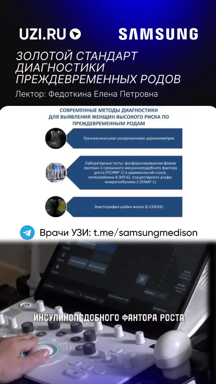 Акушерство: Золотой стандарт диагностики преждевременных родов — Федоткина Елена Петровна