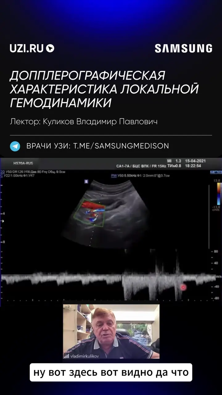 Сосуды: Допплерографическая характеристика локальной гемодинамики — Куликов Владимир Павлович